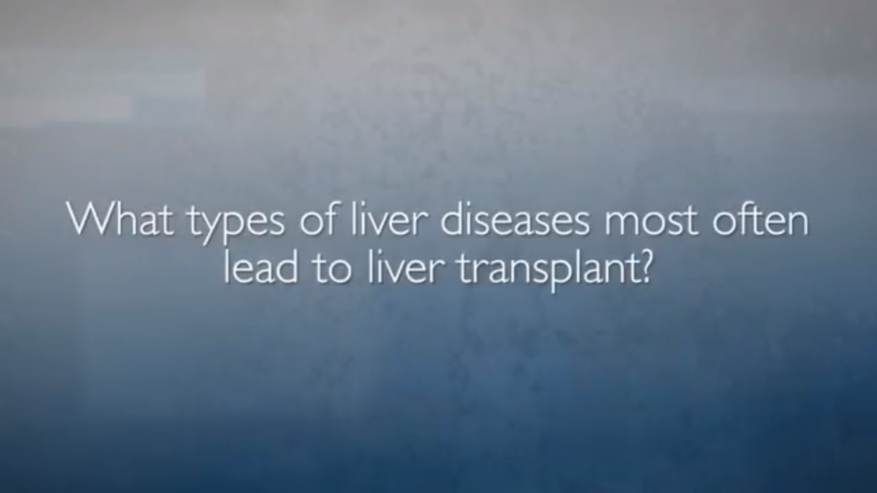 Liver Disease and Transplant: Q&amp;amp;A with Dr. Andrew Cameron - YouTube