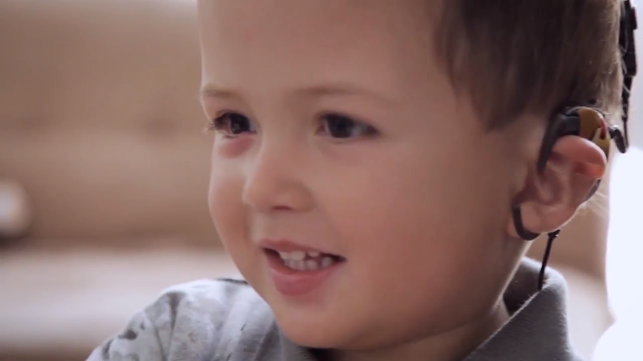 Cochlear Implant | Mateo&amp;#39;s Story - YouTube