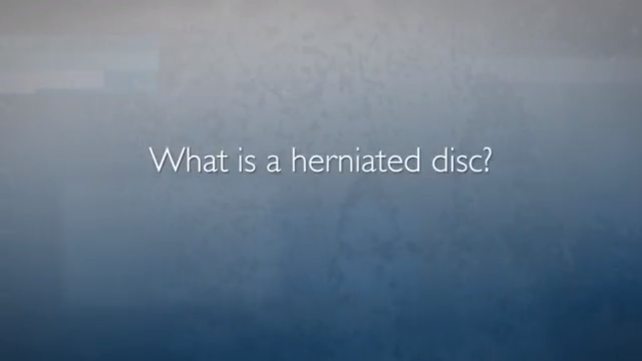 Minimally Invasive Spine Surgery: Microdiscectomy | Herniated Disc FAQ - YouTube